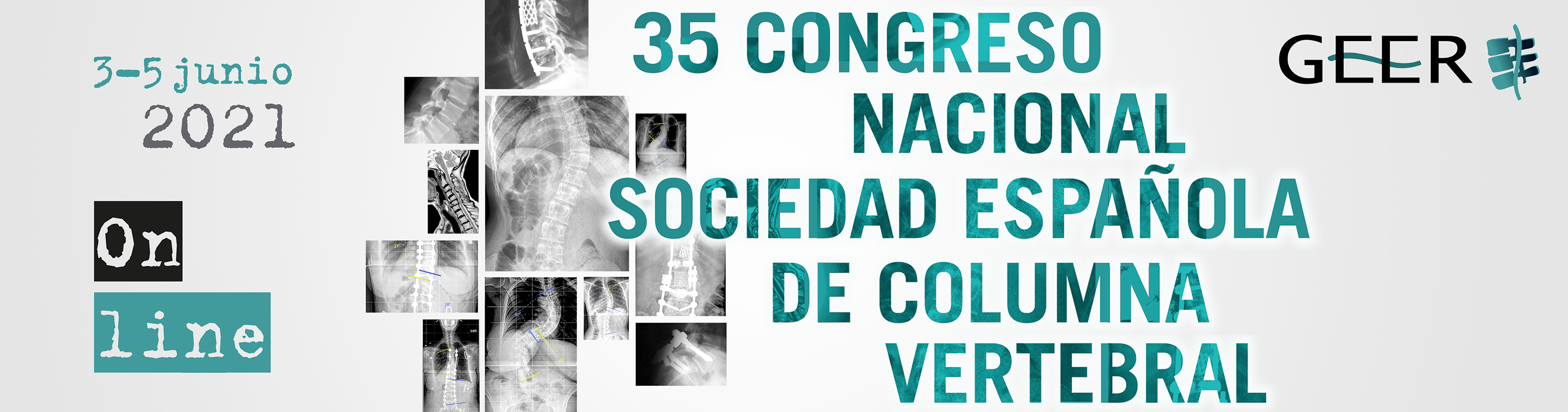 35 Congreso Nacional de la Sociedad Española de Columna Vertebral. <br />
                Online 3, 4 y 5 de junio de 2021